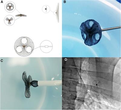 Experimental study of the bilateral asymmetric single-rivet occluder device for transcatheter patent foramen ovale closure with reserved interatrial septal puncture area